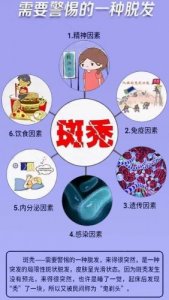 ​斑秃的症状表现(斑秃的症状表现照片)