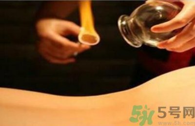 ​夏天拔火罐有什么好处？夏天拔火罐有什么坏处？