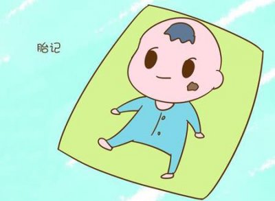 ​胎记是神仙下凡投胎的痣吗