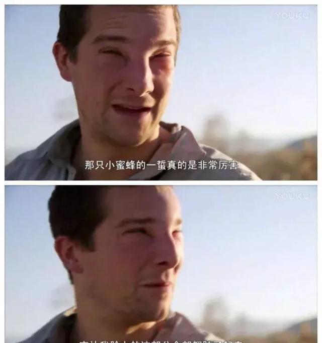 感受下各种被蜜蜂蛰后的样子,大家千万不要招蜂!不然你可能