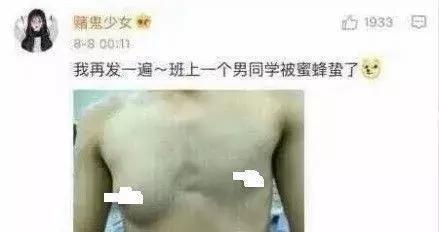 感受下各种被蜜蜂蛰后的样子,大家千万不要招蜂!不然你可能