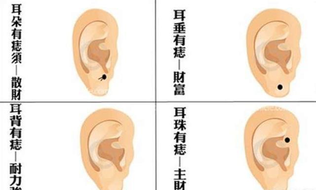 身上这三颗痣，长一颗好运，长两颗大吉大利，长三颗富贵命