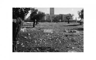 ​弟弟毛怎么办 弟弟毛可以去除吗