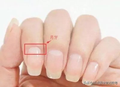 ​指甲没月牙是身体不健康的表现吗 指甲月牙少就是不健康