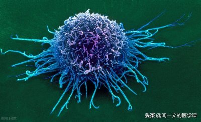 ​什么是恶性肿瘤它与癌症有区别（恶性肿瘤和癌症有啥区别？许多人都想错了，听