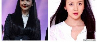 ​这些整容失败的女星，有位为美貌却死在了整形手术台上！