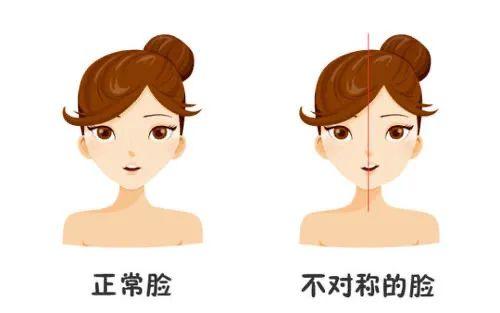 金莎公开整容（美人计金莎变美不靠整容靠正骨）(11)