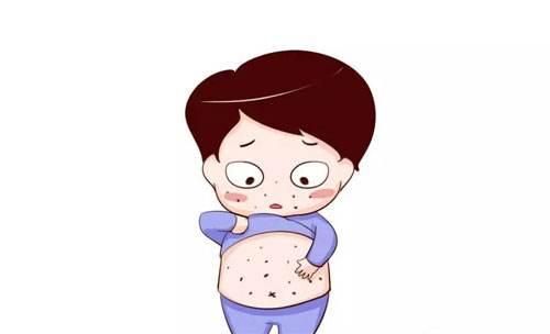 小儿慢性荨麻疹的有效治疗方法(小儿慢性荨麻疹能自愈吗)-第1张图片-