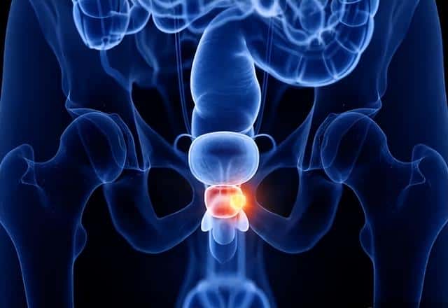 如何判断自己前列腺炎位置(1怎么找0的前列腺位置)