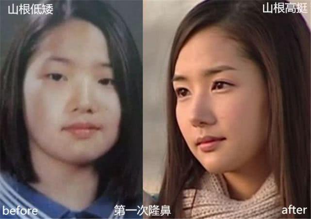 高雅拉整容,宋承宪和高雅拉结婚(宋承宪和高雅拉分手件事) 高雅拉整容,宋承宪和高雅拉结婚(宋承宪和高雅拉分手件事)