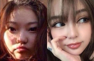 ​郑爽整容前，上学时关晓彤(关晓彤整容之前)