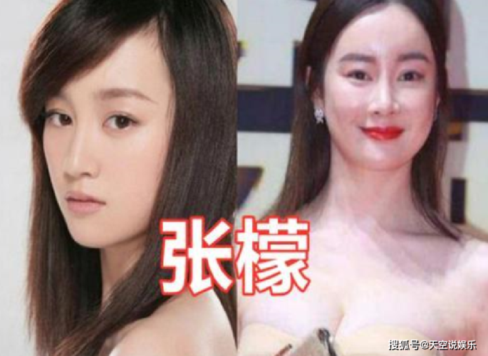 郑爽整容前,上学时关晓彤(关晓彤整容之前) 郑爽整容前,上学时关晓彤(关晓彤整容之前)