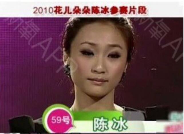 陈冰整容前后照片对比照(陈学冬 整容前后) 陈冰整容前后照片对比照(陈学冬 整容前后)