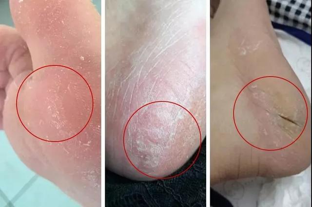 赵丽颖的脚虽然很小,但是光滑白嫩,连女人看了也免不了要心动