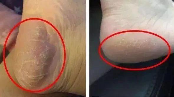 赵丽颖的脚虽然很小,但是光滑白嫩,连女人看了也免不了要心动