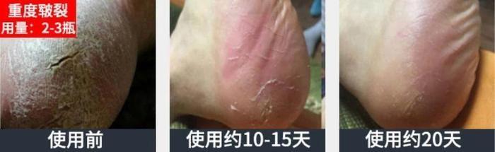 赵丽颖的脚虽然很小,但是光滑白嫩,连女人看了也免不了要心动