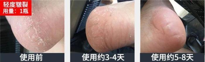 赵丽颖的脚虽然很小,但是光滑白嫩,连女人看了也免不了要心动