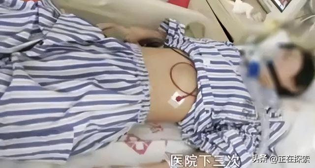 服毒自尽的人有多痛苦(服毒自杀到底有多可怕)(14)