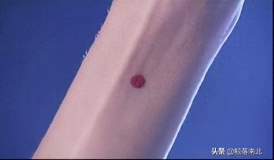​一颗红痣就能判断女子的贞洁，守宫砂是什么，它真的如此神奇吗？