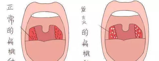 歌手张咪现在患什么病（歌手张咪自曝已癌症晚期）(15)