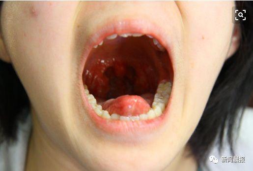 歌手张咪现在患什么病（歌手张咪自曝已癌症晚期）(14)