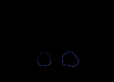 ​女方争取孩子抚养权的证据有哪些