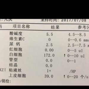 ​尿白细胞偏高是什么意思(尿白细胞偏高严重吗)