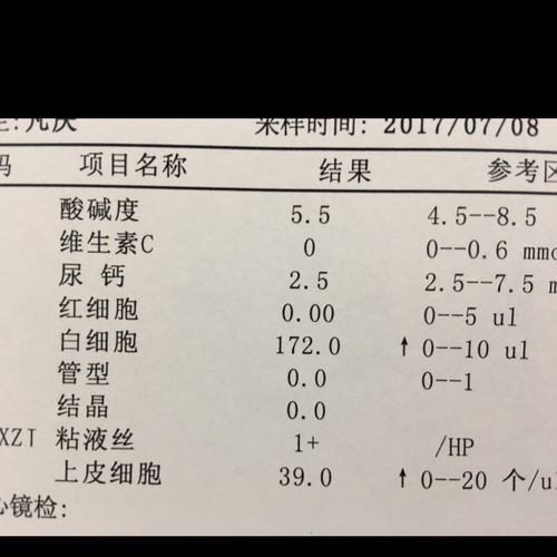 尿白细胞偏高是什么意思(尿白细胞偏高严重吗)-第1张图片-