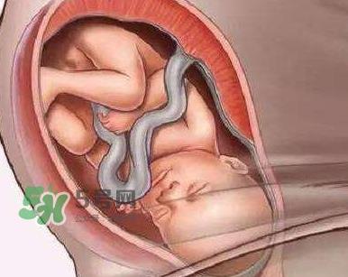 胎儿什么时候入盆?胎儿入盆后胎动会减少吗? 胎儿什么时候入盆?胎儿入盆后胎动会减少吗?