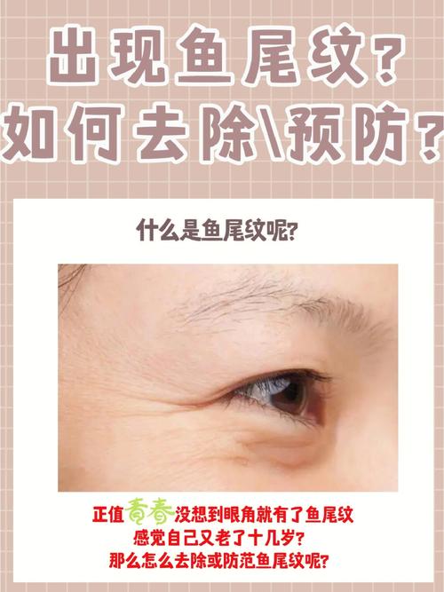 怎样去眼角的鱼尾纹(这两种土方法很有效果)