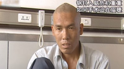 ​7厘米铁钉被砸入脑袋，10天后家人送医，如此残忍究竟何人所为？