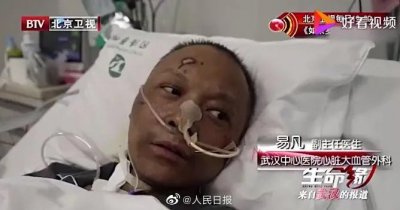 ​武汉中心医院易凡医生出院，曾人工肺维持一个多月全身变黑